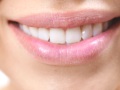 Teeth Whitening (In Office)