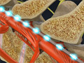 Spinal Cord Stimulation (Boston Scientific)