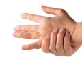 Rheumatoid Arthritis (RA) of the Hand (Arthritis Foundation Approved)