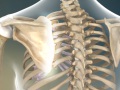 Snapping Scapula Syndrome