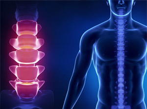 Education about lower back pain causes and chiropractic care after an auto accident