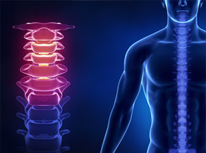 Education about neck pain and chiropractic care after an auto accident