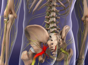 Educational video for Sciatica Care at Advanced Health Chiropractic in Livermore