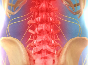 Education about spinal decompression